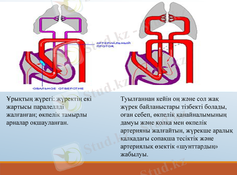 Slide 11