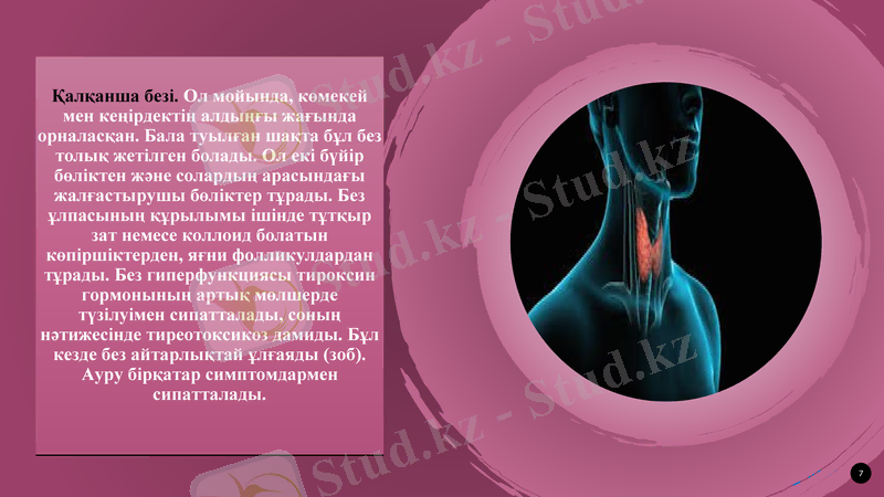 Slide 7