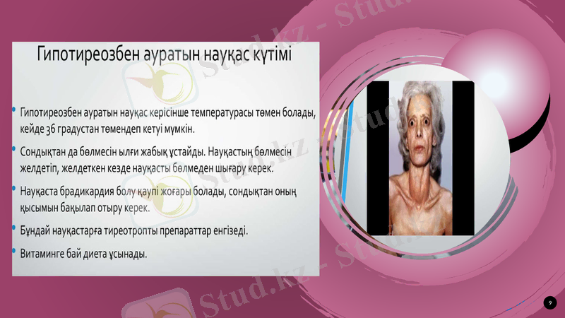 Slide 9