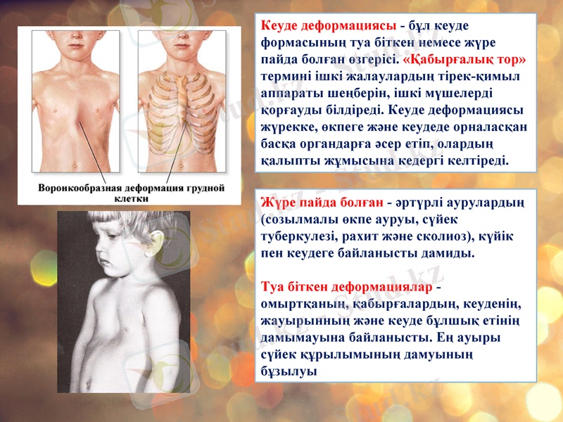 Slide 11