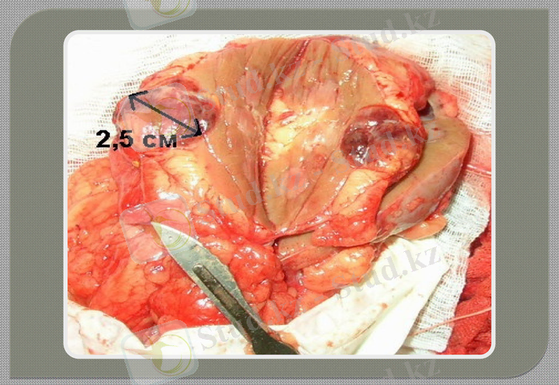 Slide 12