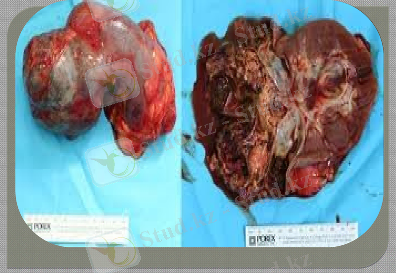 Slide 14