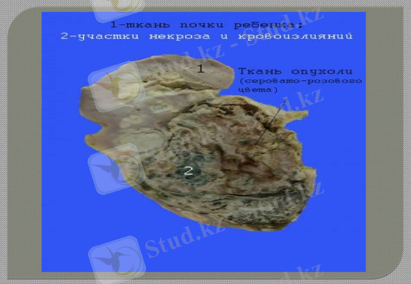 Slide 15