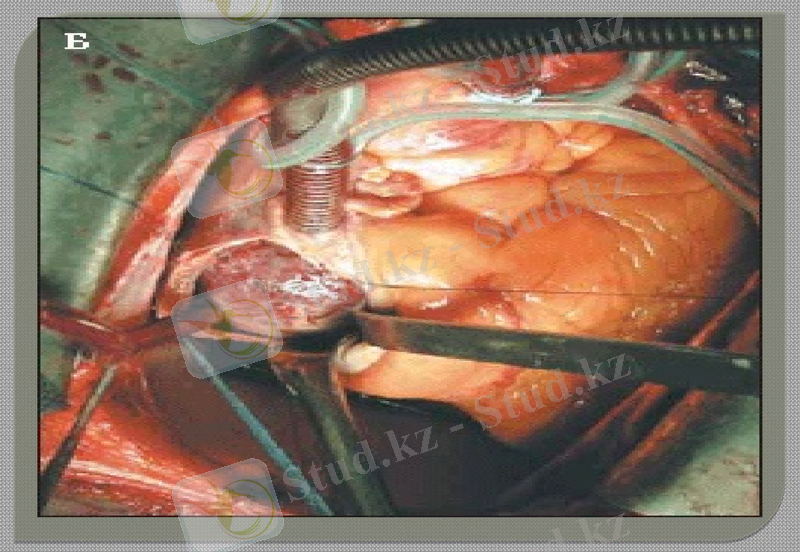 Slide 16