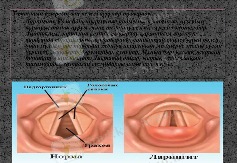 Slide 13