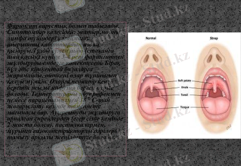 Slide 15