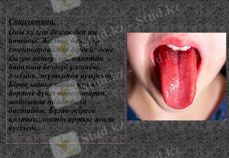 Slide 17