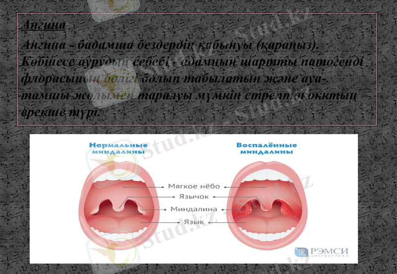 Slide 19