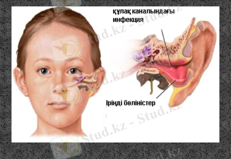 Slide 36