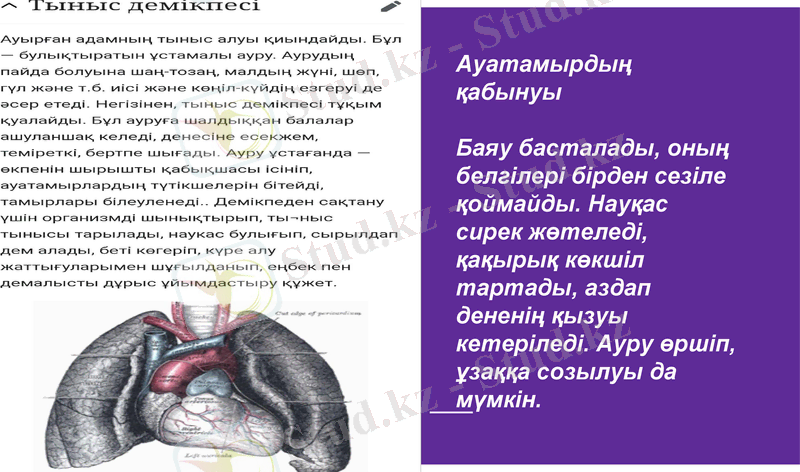 Slide 10