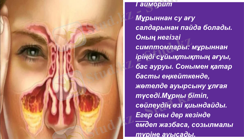 Slide 11