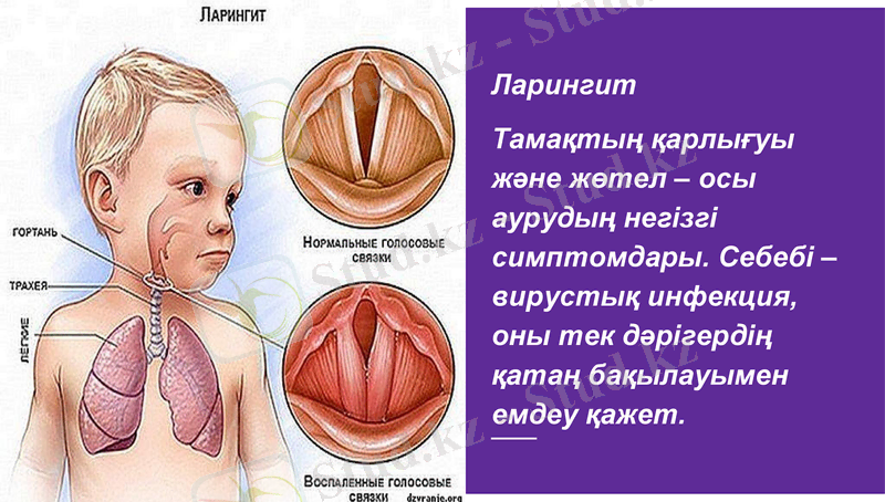 Slide 12