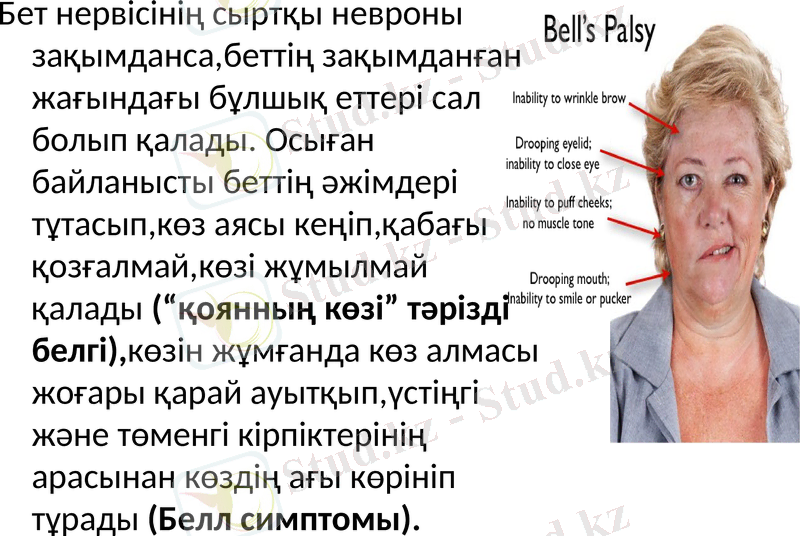 Slide 32
