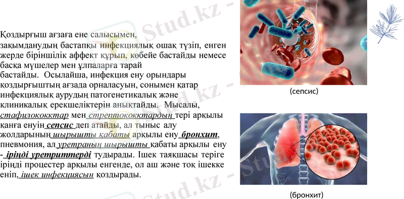 Slide 14