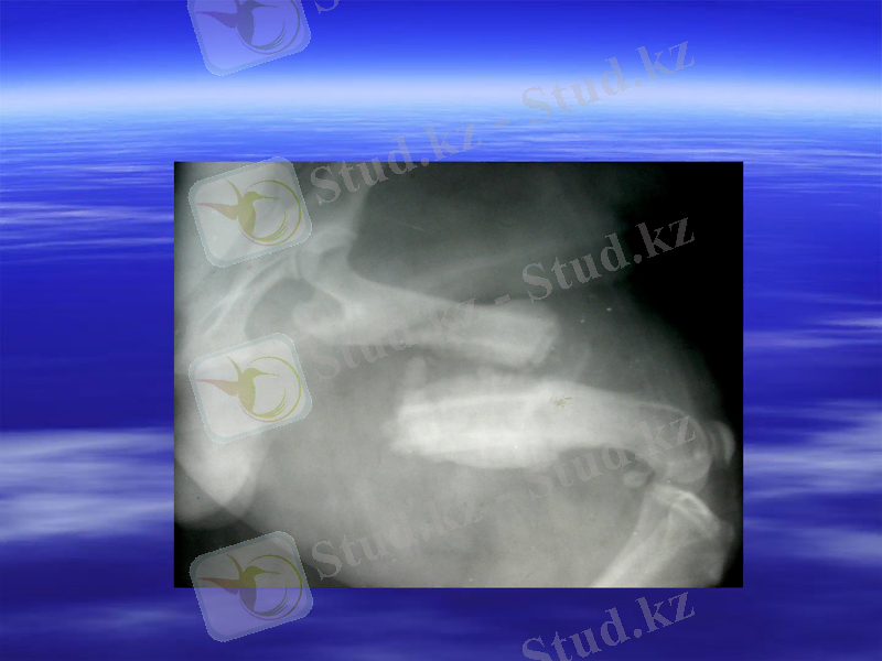 Slide 11
