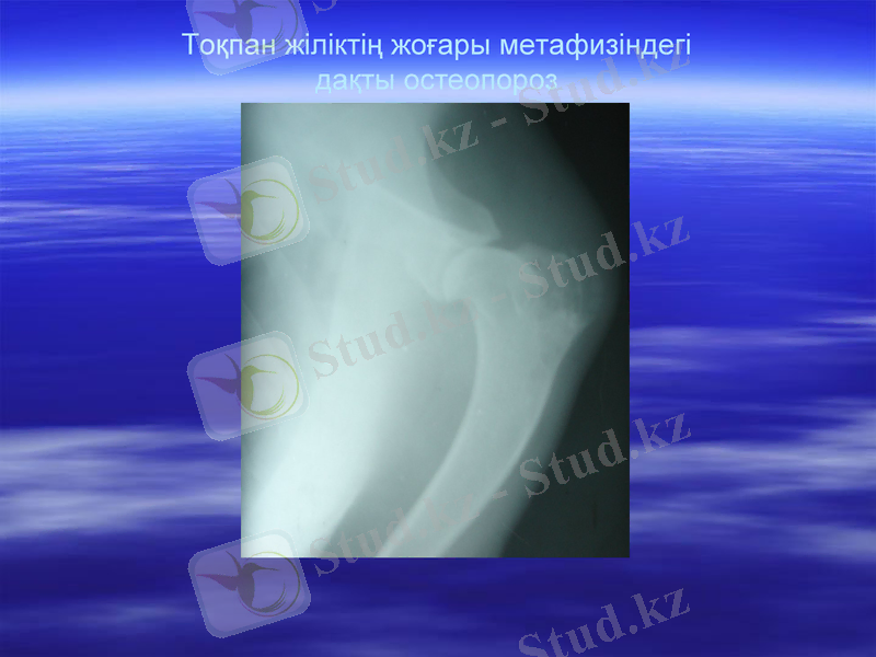 Slide 17