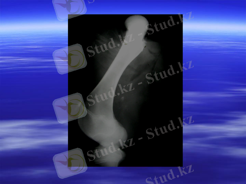 Slide 6
