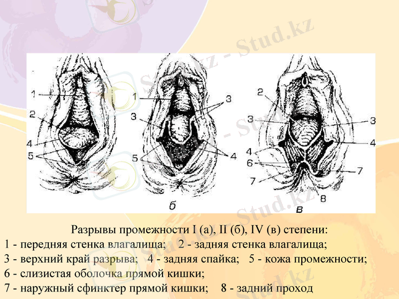 Slide 10