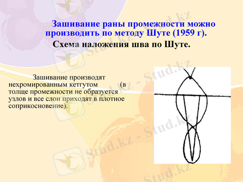 Slide 11