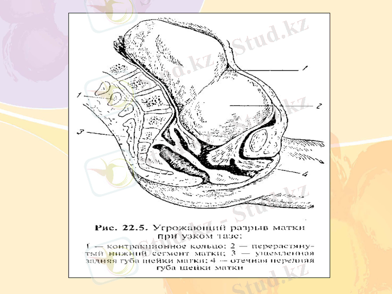 Slide 20