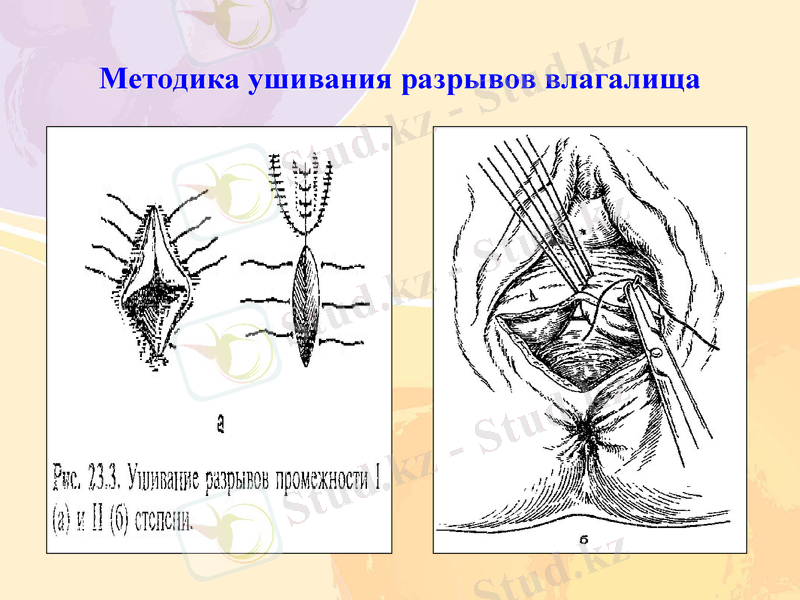 Slide 7