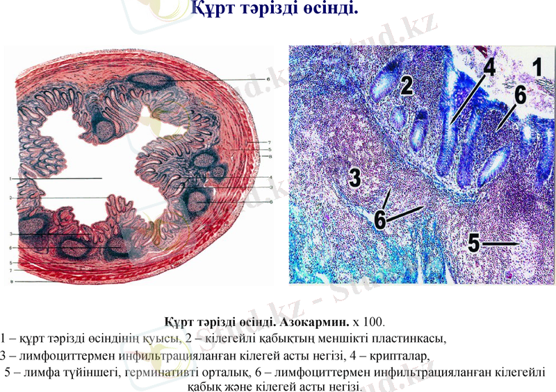 Slide 14