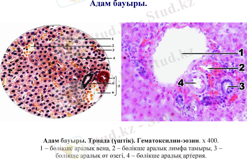 Slide 18