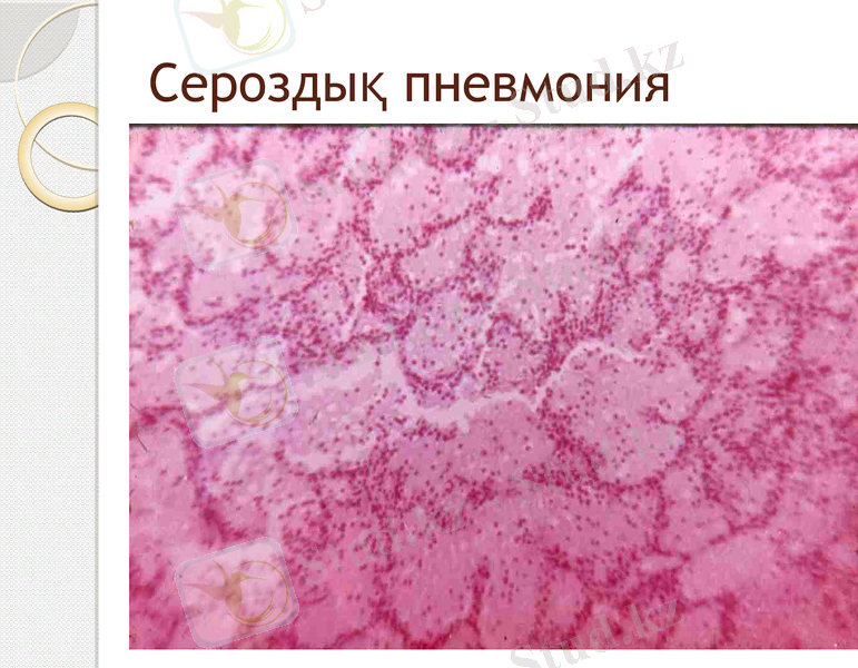 Slide 13