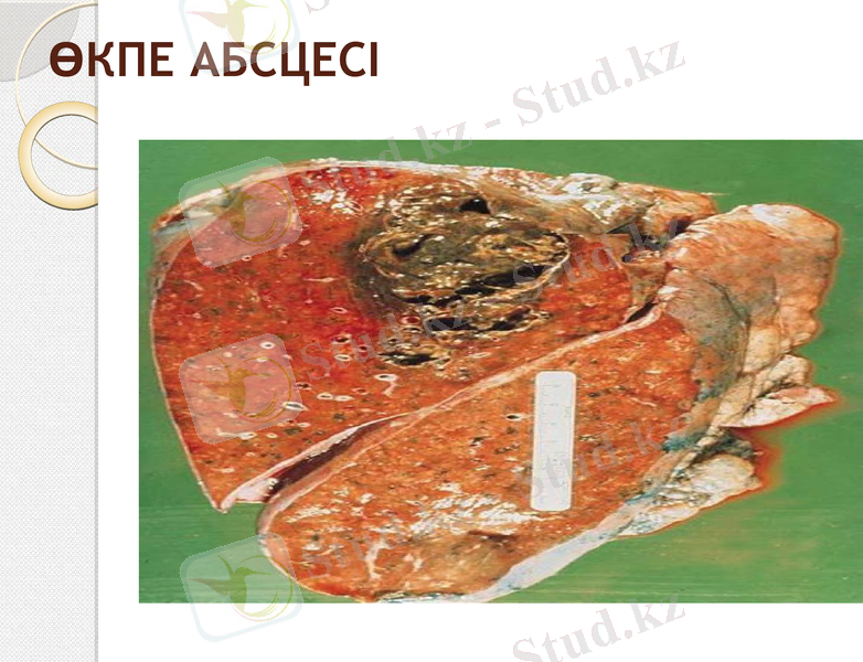 Slide 17
