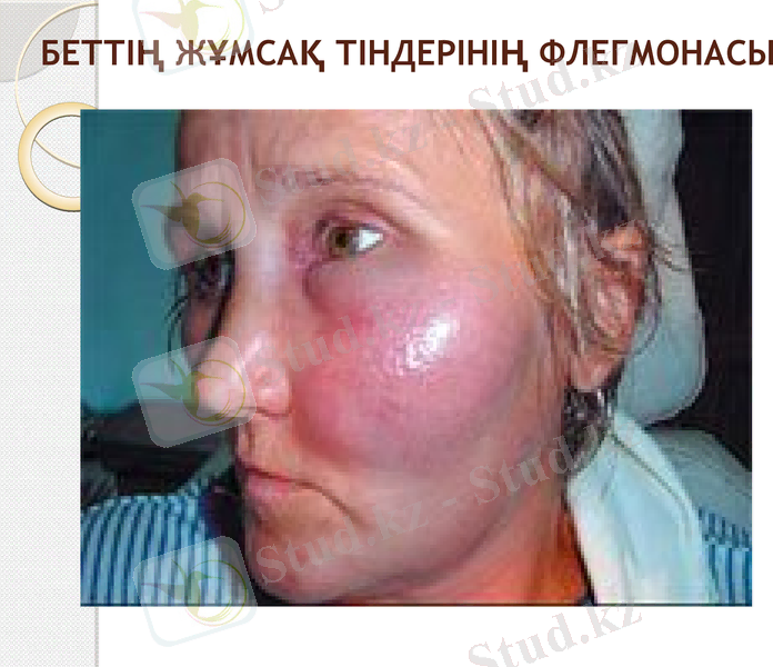 Slide 18