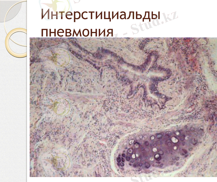 Slide 24