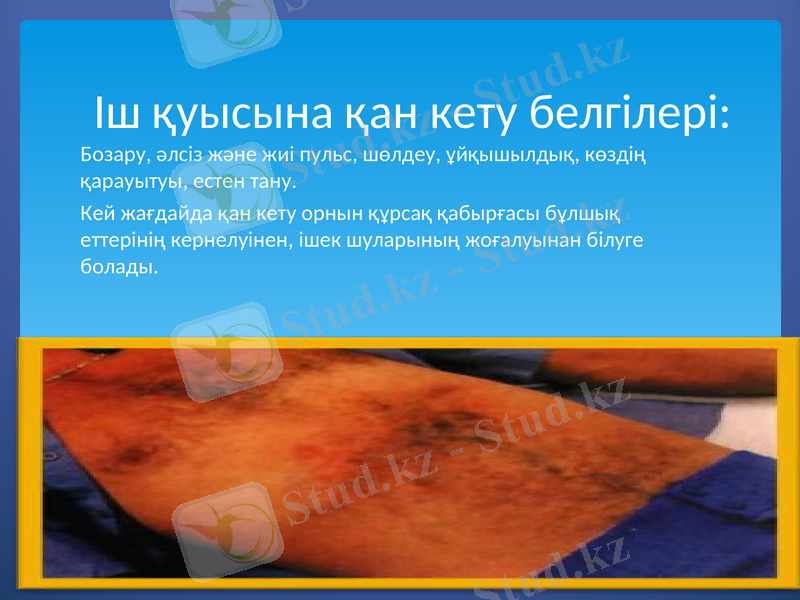 Slide 12