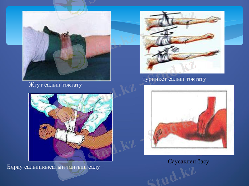 Slide 15