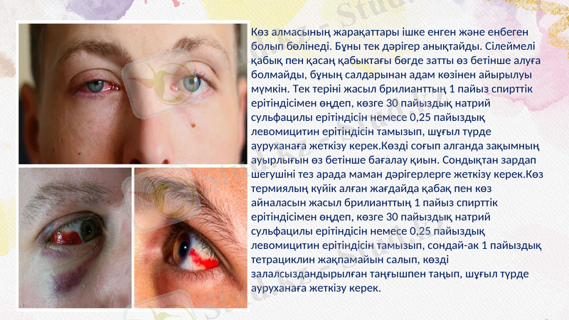 Slide 9