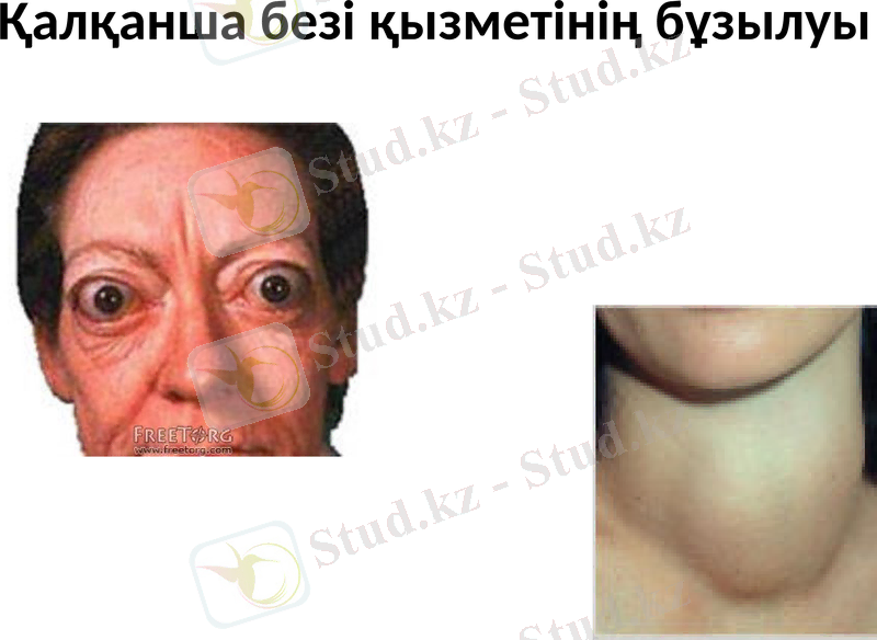 Slide 17