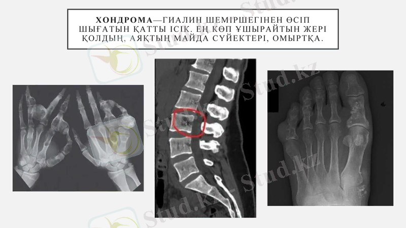 Slide 11