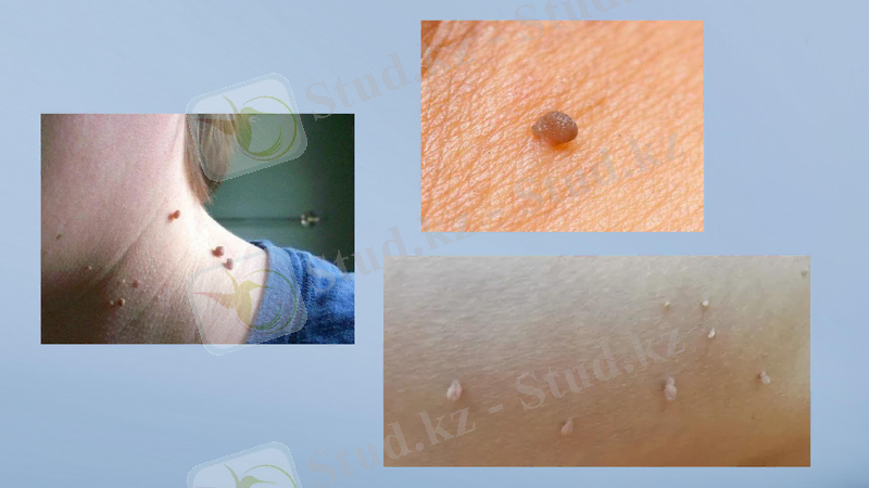 Slide 13