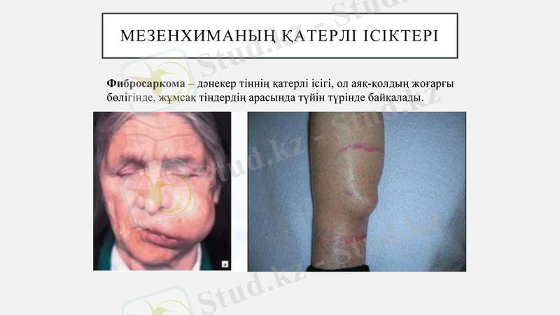 Slide 17