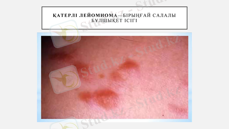 Slide 20
