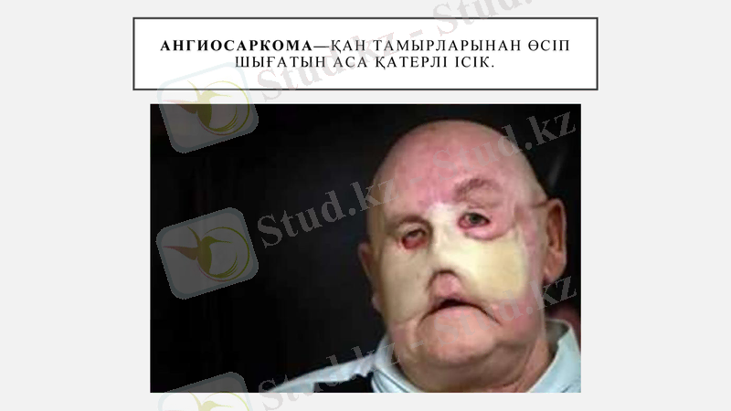 Slide 22