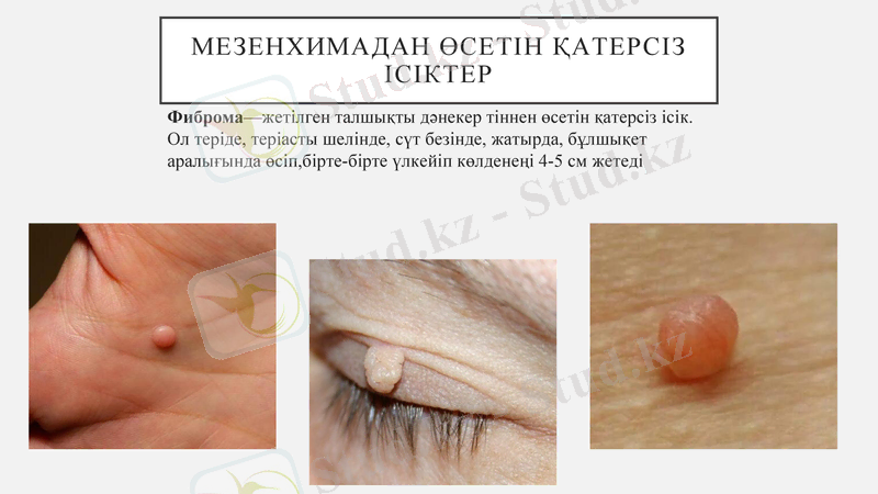 Slide 6