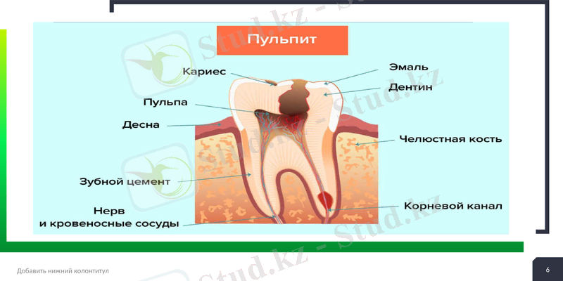 Slide 6