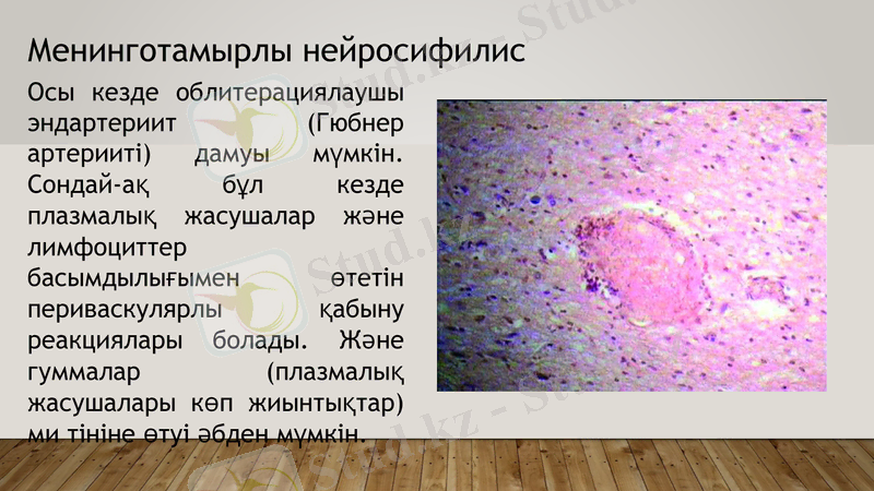 Slide 6