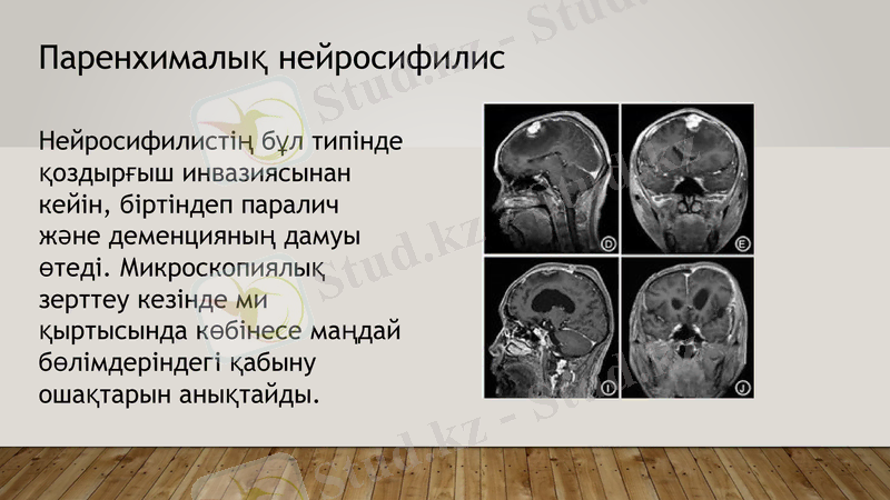 Slide 7