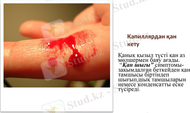 Slide 11