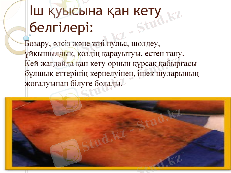 Slide 15