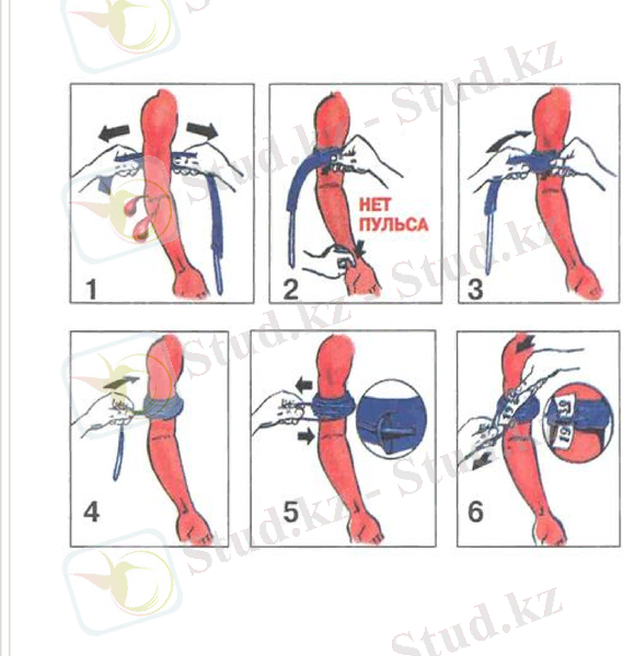 Slide 22