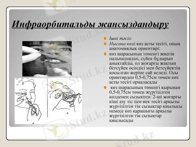 Slide 19