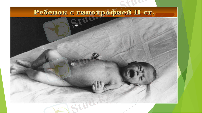 Slide 12