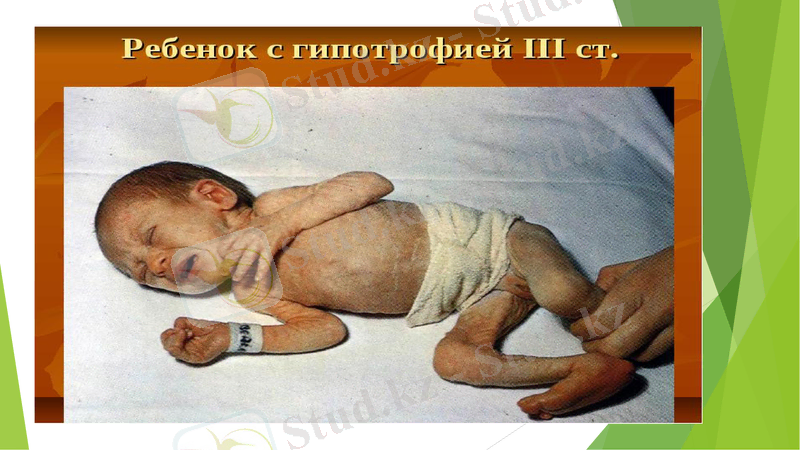 Slide 15